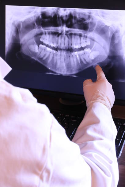Best Emergency Dentist for Lost Fillings or Crowns in Gananda, NY