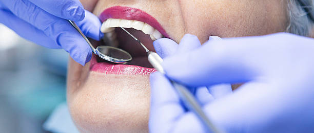 Best Emergency Dentist for Knocked-Out Tooth in Gananda, NY